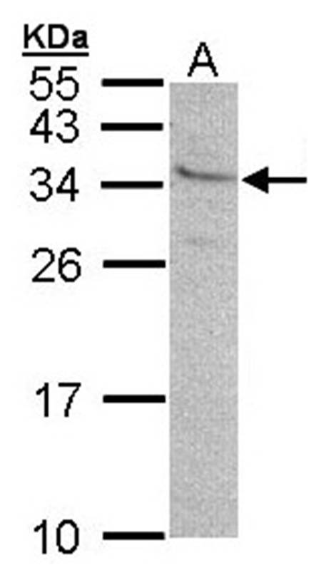 Anti-GEM Antibody