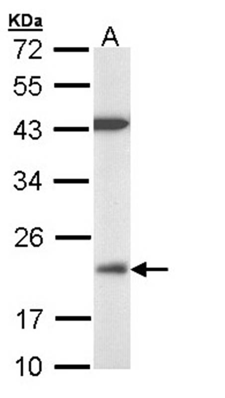 Anti-VHR Antibody