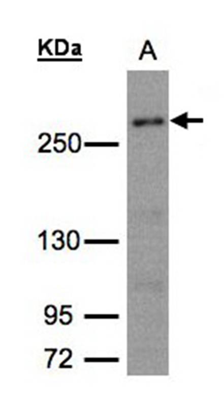 Anti-CAD Antibody
