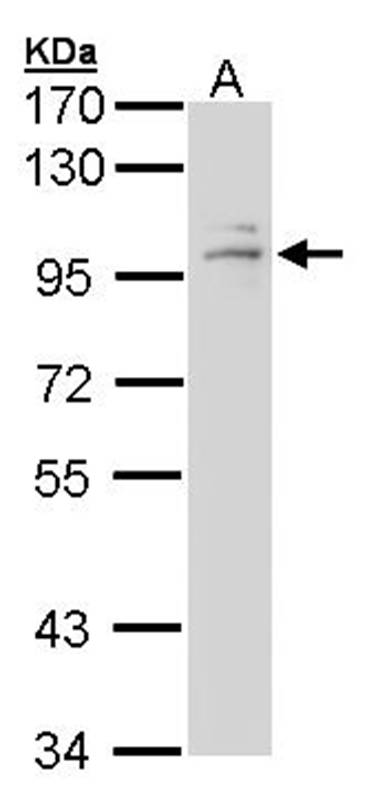 Anti-GR Antibody