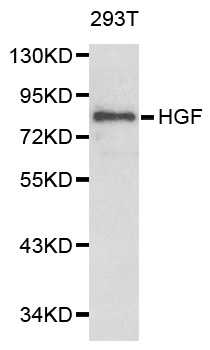 Anti-HGF Antibody