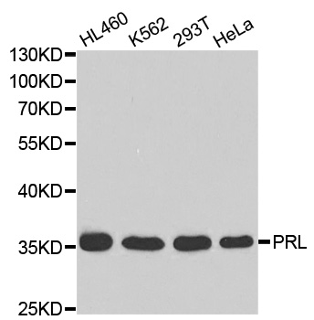 Anti-PRL Antibody