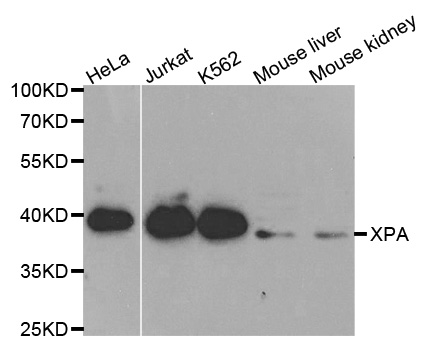 Anti-XPA Antibody
