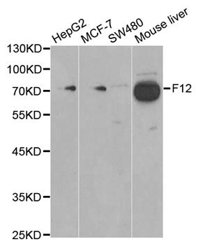Anti-F12 Antibody