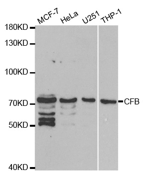 Anti-CFB Antibody