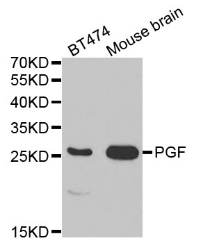 Anti-PGF Antibody