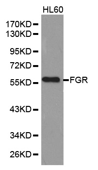 Anti-FGR Antibody