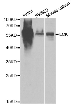 Anti-LCK Antibody