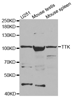 Anti-TTK Antibody