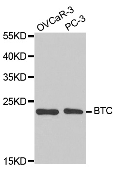 Anti-BTC Antibody