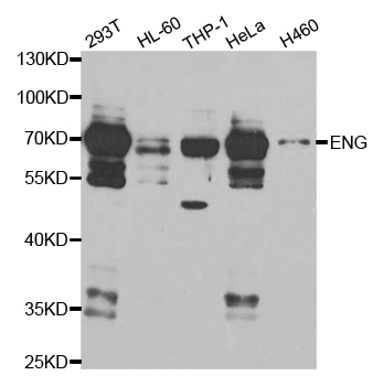 Anti-ENG Antibody