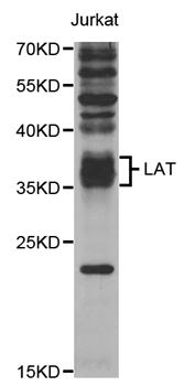 Anti-LAT Antibody