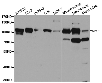 Anti-MME Antibody