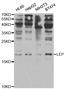 Anti-LEP Antibody
