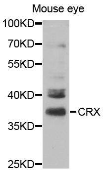 Anti-CRX Antibody