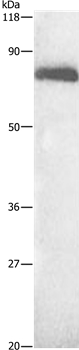Anti-ALB Antibody