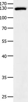 Anti-EGF Antibody
