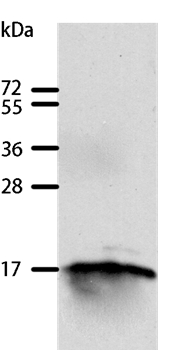Anti-GIP Antibody