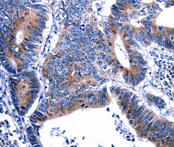 Anti-GIP Antibody Anti-GIP Antibody