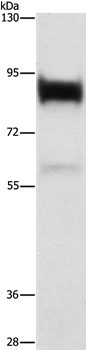 Anti-LTF Antibody