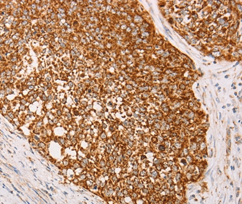 Anti-AK2 Antibody Anti-AK2 Antibody