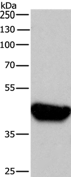 Anti-BRE Antibody