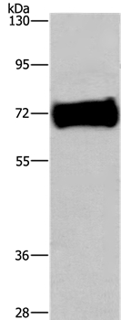 Anti-EZR Antibody