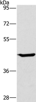 Anti-GCK Antibody