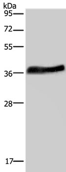 Anti-LUM Antibody