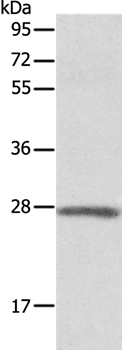 Anti-ADM Antibody