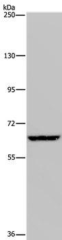 Anti-IVL Antibody