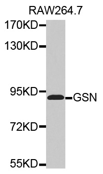 Anti-GSN Antibody