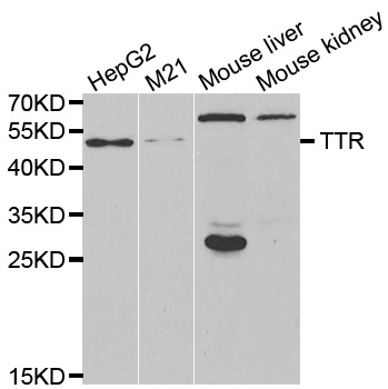 Anti-TTR Antibody