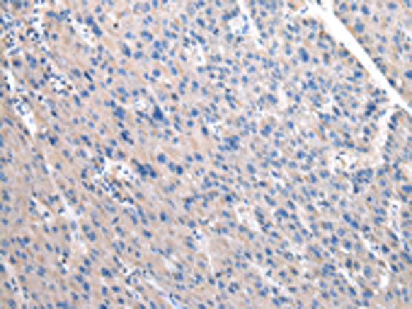 Anti-OAT Antibody Anti-OAT Antibody