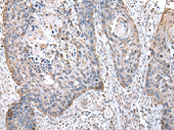 Anti-OAT Antibody Anti-OAT Antibody