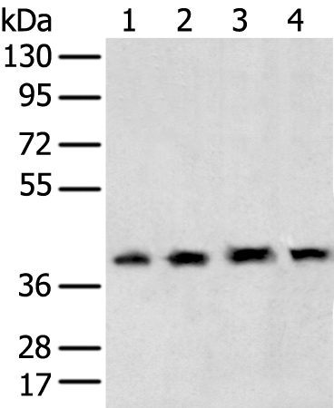 Anti-TBP Antibody