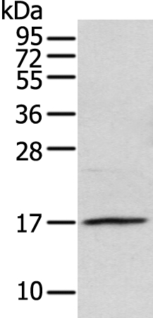 Anti-NDP Antibody