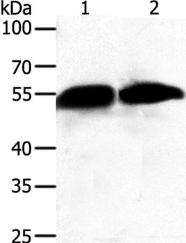 Anti-GC Antibody