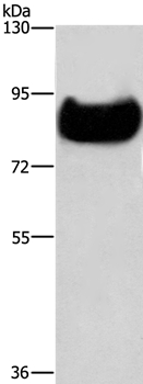 Anti-TF Antibody