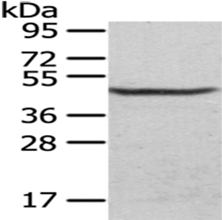 Anti-CS Antibody