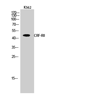 Anti-CRF-RII Antibody