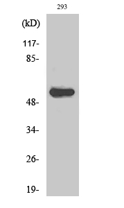 Anti-AIRE-1 Antibody