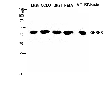 Anti-GHRH-R Antibody