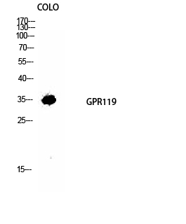 Anti-GPR119 Antibody