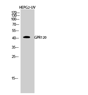 Anti-GPR120 Antibody