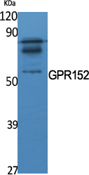 Anti-GPR152 Antibody Anti-GPR152 Antibody