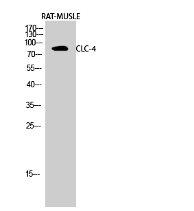 Anti-CLC-4 Antibody