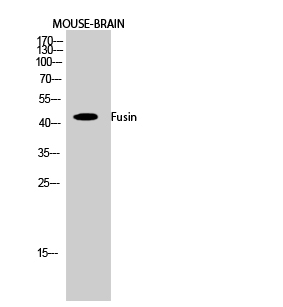 Anti-Fusin Antibody