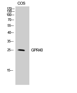 Anti-GPR40 Antibody