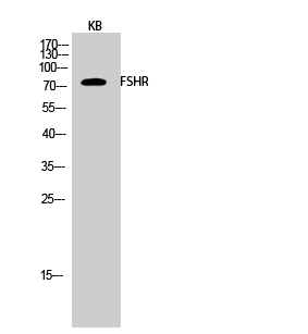 Anti-FSHR Antibody